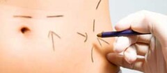 cirurgia-plastica-em-campinas-1426188677